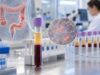 Signatera Test for Colon Cancer: ctDNA Recurrence Monitoring and MRD Detection Learn how Signatera uses tumor-informed ctDNA to detect molecular residual disease after colon cancer treatment, what positive and negative results mean, and how MRD monitoring may guide care.