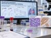 Small Cell Lung Cancer Biomarker Panel: ProGRP, NSE, DLL3, and Disease Monitoring Understand how ProGRP, NSE, and DLL3 biomarkers are used in small cell lung cancer, including blood-test trends, DLL3 expression, monitoring limits, and result interpretation.
