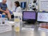 Synovial Fluid Analysis Test: Joint Fluid, Crystals, Infection, and Inflammation Understand what a synovial fluid analysis tests, how joint fluid cell counts, crystals, Gram stain, and culture help distinguish infection, gout, inflammation, bleeding, and degenerative disease.