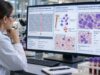 TET2 Mutation Test: Blood Cancer, Clonal Hematopoiesis, Myeloid Neoplasms, and Mutation Meaning Understand TET2 mutation testing, including CHIP and CCUS, AML and MDS associations, variant allele frequency, cancer risk, prognosis, and appropriate follow-up.