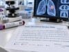 Tumor Mutational Burden (TMB) Test for Lung Cancer: Mutation Load, Genomic Score, and Meaning Learn what a lung cancer TMB test measures, how mutations per megabase are calculated, what TMB-high means, and how the score fits with PD-L1, NGS, and immunotherapy decisions.