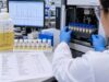 24-Hour Urine Amino Acids Test: Metabolic Disorders and Amino Acid Excretion Learn what a 24-hour urine amino acids test measures, why aminoaciduria occurs, which metabolic and kidney disorders can cause it, and how results are interpreted.
