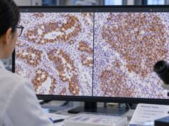 ALK IHC Test: ALK Protein Expression, Lung Cancer, Lymphoma, and Fusion Screening Learn what an ALK IHC test detects, how ALK positivity is interpreted in lung cancer and lymphoma, and when FISH or NGS is used to confirm an ALK fusion.