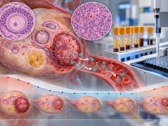 Understand how AMH testing can track ovarian granulosa cell tumor activity, treatment response, and recurrence, plus what high or changing levels may mean.