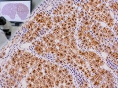 Arginase-1 IHC Test: Liver Cancer Marker, Hepatocellular Differentiation, and Tumor Origin Learn how the arginase-1 IHC test supports hepatocellular carcinoma, what positive staining means, and how it helps distinguish liver origin from metastatic tumors.