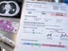 BRAF V600E Test for Lung Cancer: Mutation Status, Positive Result, and Molecular Meaning Understand BRAF V600E testing in lung cancer, including what a positive or negative result means, tissue and ctDNA methods, limitations, and treatment relevance.