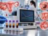 CA-125 Test for Ovarian Cancer: High Levels, Monitoring, Recurrence, and Benign Causes Learn what high CA-125 levels can mean, common benign causes, how CA-125 tracks ovarian cancer treatment and recurrence, and why one result cannot diagnose cancer.