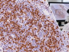 CD3 IHC Test: T-Cell Lymphoma Marker, T-Cell Lineage, and Positive Staining Learn what CD3 IHC positive staining means, how CD3 supports T-cell lineage, and why reactive T cells, antigen loss, and NK/T-cell lymphoma can complicate interpretation.