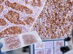 Understand CD45 (leukocyte common antigen) IHC, what positive or negative staining means, how it helps identify lymphoma, and why marker panels are essential.