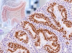 Understand what CD117 (c-KIT) IHC positivity means in GIST, mast cell disorders, leukemia, and other tumors, including staining patterns and follow-up tests.