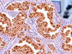 Calretinin IHC Test: Mesothelioma Marker, Tumor Origin, and Positive Staining Learn what calretinin IHC positive staining means, how it supports mesothelioma and mesothelial origin, and why BAP1, MTAP, and carcinoma markers are often needed.