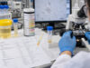 Complete Urinalysis Test: Chemical, Microscopic, and Physical Urine Findings Learn what a complete urinalysis measures, including physical urine findings, dipstick chemistry, microscopy, normal patterns, abnormal results, and follow-up.