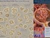 Dysmorphic Red Blood Cells in Urine: Glomerular Hematuria and Kidney Filter Disease Dysmorphic red blood cells in urine can point to glomerular hematuria. Learn what acanthocytes mean, common kidney causes, test limits, and follow-up.