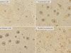 Epithelial Cells in Urine Test: Squamous, Transitional, Renal Cells, and Contamination Epithelial cells in urine may be squamous, transitional, or renal tubular. Learn what high counts mean, how contamination affects results, and when follow-up matters.