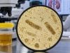 Granular Casts in Urine: Kidney Tubule Injury, Acute Kidney Injury, and Meaning Granular casts in urine may signal acute tubular injury, especially when muddy brown and abundant. Learn causes, AKI meaning, microscopy clues, and follow-up.