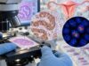 HER2 Test for Endometrial Cancer: HER2 Expression, Amplification, and Tumor Subtype Learn how HER2 testing in endometrial cancer measures protein expression and ERBB2 amplification, how IHC and FISH results are interpreted, and why HER2 status can affect treatment in uterine serous carcinoma.