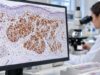 Learn what HMB-45 IHC positivity means, how the melanoma marker is interpreted with S100, SOX10, and Melan-A, and why staining alone is not diagnostic.