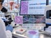 HRD Test for Ovarian Cancer: Homologous Recombination Deficiency, DNA Repair, and Genomic Score Learn how HRD testing in ovarian cancer evaluates homologous recombination repair, BRCA mutations, genomic scars and instability scores, and how HRD results can influence PARP inhibitor treatment decisions.