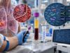 Lung Cancer Liquid Biopsy Test: ctDNA, Mutations, Resistance Markers, and Blood-Based Testing Learn how lung cancer liquid biopsy uses ctDNA to detect actionable mutations and resistance markers, what positive and negative results mean, and when tissue testing is still needed.