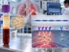 MET Amplification Test for Lung Cancer: Copy Number Gain, Resistance Marker, and Meaning Learn how MET amplification testing measures lung cancer copy-number gain, how FISH and NGS results differ, why MET can cause EGFR resistance, and what positive or negative results may mean.