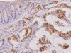 The MUC2 IHC test detects intestinal goblet-cell mucin. Learn what positive staining means in colorectal, appendiceal, pancreatic, and mucinous tumors and how MUC2 fits into IHC panels.