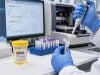 Learn how Mycoplasma and Ureaplasma urine NAAT results differ, when M. genitalium testing is useful, why Ureaplasma may represent colonization, and how resistance affects follow-up.