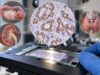 Learn what PAX8 IHC positive staining means and how PAX8 helps identify ovarian, kidney, and thyroid tumor origin when interpreted with a focused marker panel.