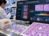 Learn how the Prolaris test measures 31 cell-cycle genes, what higher or lower scores mean, and how results can refine prostate cancer surveillance and treatment.