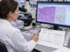 ROMA Test for Ovarian Cancer Risk: CA-125, HE4, Menopause Status, and Risk Score Learn how the ROMA ovarian cancer risk test combines CA-125, HE4, and menopause status, why cutoffs vary by assay, and what high or low risk scores mean before surgery.