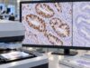 Understand SATB2 IHC positive staining, how it supports colorectal or lower-GI origin, why some tumors are negative, and which marker panels improve accuracy.