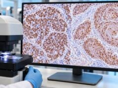 SOX2 IHC Test: Germ Cell Tumor, Squamous Cancer Marker, and Staining Meaning Learn how SOX2 IHC is interpreted in embryonal carcinoma, seminoma differentials, and squamous cancer, including positive staining patterns, panels, and pitfalls.