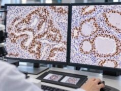TTF-1 IHC Test: Lung Cancer, Thyroid Cancer, Tumor Origin, and Positive Staining Learn what TTF-1 IHC positive nuclear staining means in lung and thyroid cancer, how Napsin A and PAX8 help, and why false-positive or negative results occur.
