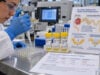 Tubular Proteinuria Test: Low-Molecular-Weight Proteins and Kidney Tubule Damage Learn how tubular proteinuria tests detect low-molecular-weight proteins, what high RBP or microglobulins mean, causes of proximal tubule damage, and how results differ from albuminuria.
