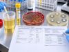 UTI Test Panel: Urinalysis, Urine Culture, Sensitivity, and Infection Markers Understand a UTI test panel, including urinalysis, leukocyte esterase, nitrite, WBCs, urine culture, CFU colony count, and antibiotic susceptibility results.
