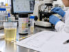 Urinalysis Test: Dipstick, Microscopy, Normal Results, and What It Means Learn how a urinalysis test works, including dipstick markers, urine microscopy, normal results, common abnormal patterns, test limitations, and follow-up.