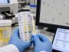 Urinalysis for UTI: Leukocyte Esterase, Nitrites, WBCs, Bacteria, and Meaning Understand leukocyte esterase, nitrites, WBCs, bacteria, and other urinalysis findings for UTI, including common result patterns, false positives, and when culture is needed.