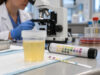 Urinalysis for UTI: Leukocytes, Nitrites, Bacteria, WBCs, and Culture Follow-Up Understand UTI urinalysis results for leukocytes, nitrites, WBCs, bacteria, pyuria, and culture, including false results and when follow-up testing is needed.