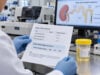 Learn how to calculate the urine anion gap, what negative and positive values can mean in normal-anion-gap metabolic acidosis, and why direct urine ammonium is often preferred.
