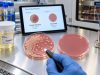Urine Culture Test: Positive, Negative, Bacteria, Colony Count, and Meaning Understand urine culture results, including positive and negative findings, bacteria, CFU colony counts, mixed flora, contamination, and antibiotic susceptibility.