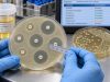 Urine Culture and Sensitivity Test: Antibiotic Susceptibility, Bacteria Type, and Meaning Learn how a urine culture and sensitivity test identifies bacteria, reports colony growth, measures antibiotic susceptibility, and what susceptible, intermediate, and resistant results mean.