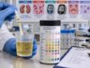Urine Dipstick Test: Protein, Blood, Glucose, Ketones, Nitrites, and Leukocytes Understand urine dipstick test: protein, blood, glucose, ketones, nitrites, and leukocytes, including what the result measures, common causes, false results, confirmatory testing, and when medical follow-up matters.