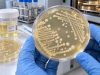 Urine Fungal Culture Test: Yeast, Candida, Fungal UTI, and Meaning Learn what a urine fungal culture means, why Candida or yeast may appear in urine, how candiduria differs from fungal UTI, and when treatment or more testing may be needed.