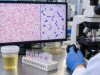 Urine Gram Stain Test: Bacteria Type, Infection, and Preliminary Culture Clues Learn how a urine Gram stain shows gram-negative or gram-positive bacteria, what a negative result means, and how preliminary findings compare with urine culture.