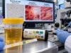 Urine Hemoglobin Test: Positive Result, Blood, Hemolysis, Myoglobin, and Meaning Understand urine hemoglobin test: positive result, blood, hemolysis, myoglobin, and meaning, including what the result measures, common causes, false results, confirmatory testing, and when medical follow-up matters.
