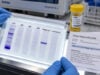Urine Immunofixation Test: Monoclonal Protein, Light Chains, and Plasma Cell Disorders Learn what urine immunofixation detects, what a monoclonal kappa or lambda band means, how it differs from UPEP, and how positive results are evaluated.