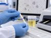 Urine Leukocyte Esterase Test for UTI: Positive Result, White Blood Cells, and Meaning Learn what a positive urine leukocyte esterase test means, how it relates to white blood cells and UTI, why false results happen, and when culture is needed.