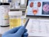 Urine Nitrite Test: Positive Result, UTI, Bacteria, and Meaning Learn what a positive urine nitrite test means, why UTIs can be nitrite-negative, which bacteria produce nitrite, and when urine culture or medical follow-up is needed.