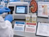 Learn how the urine osmolal gap estimates ammonium excretion, how it helps evaluate normal-anion-gap metabolic acidosis, and when the calculation can mislead.