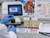 Understand urine osmolality results, including high and low values, hydration, hyponatremia, polyuria, kidney concentration, and diabetes insipidus evaluation.
