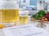 A urine oxalate test helps identify hyperoxaluria, calcium oxalate stone risk, diet and malabsorption causes, useful ranges, and practical ways to lower urinary oxalate.